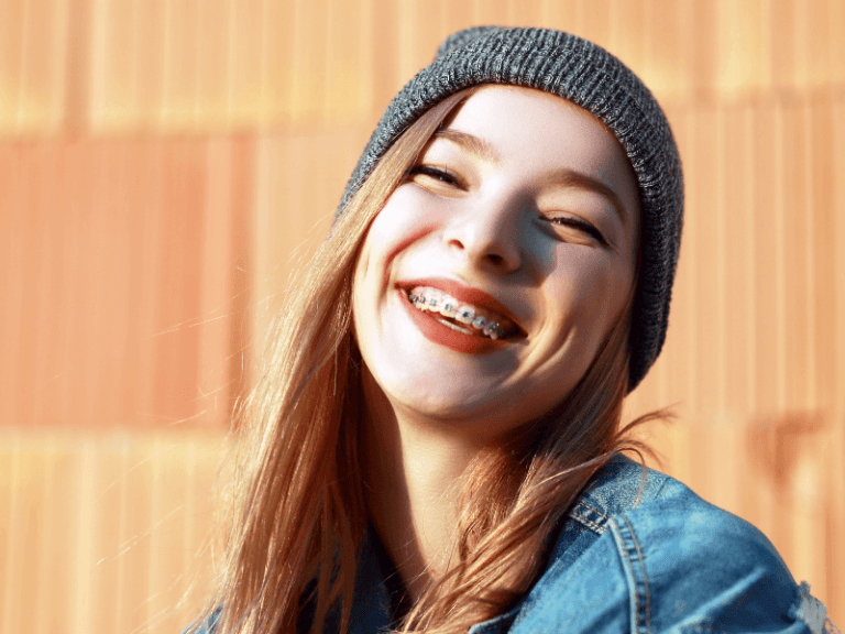Imagem de jovem a sorrir com aparelho dentário