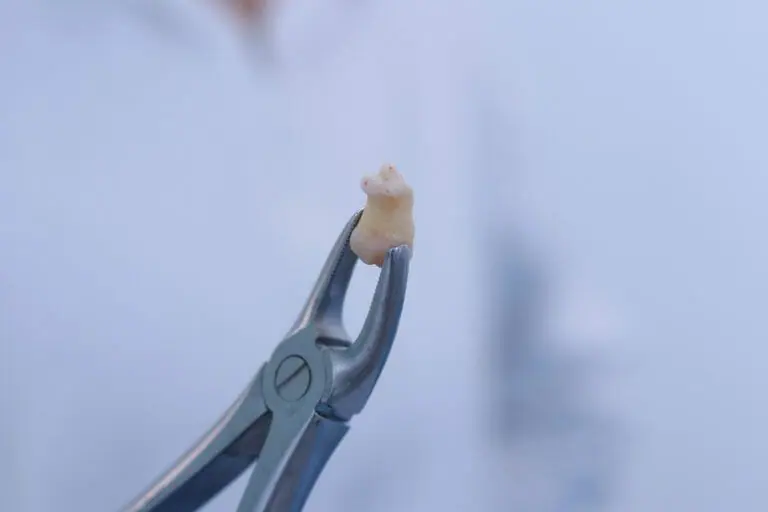 Imagem de um dente extraído