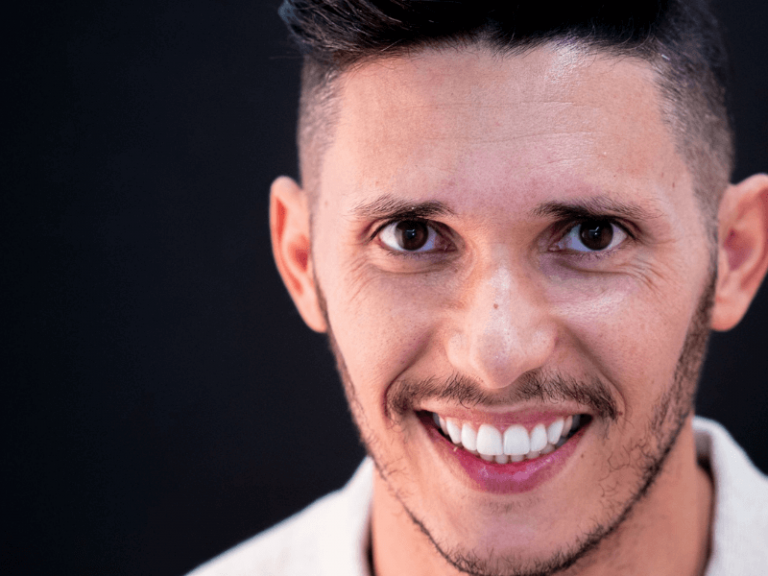 imagem de um resultado de um tratamento com facetas dentarias