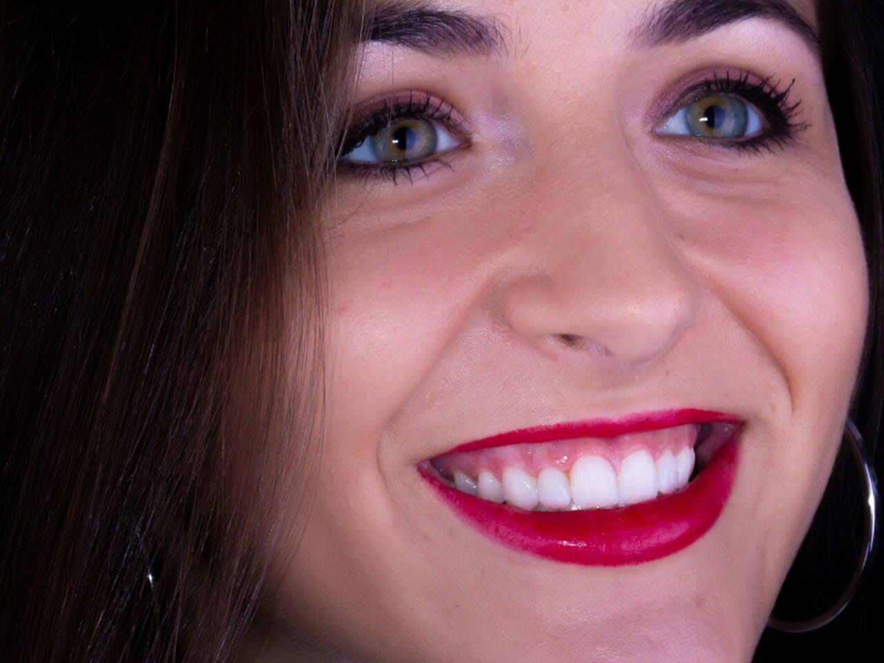 imagem de paciente com facetas de porcelana