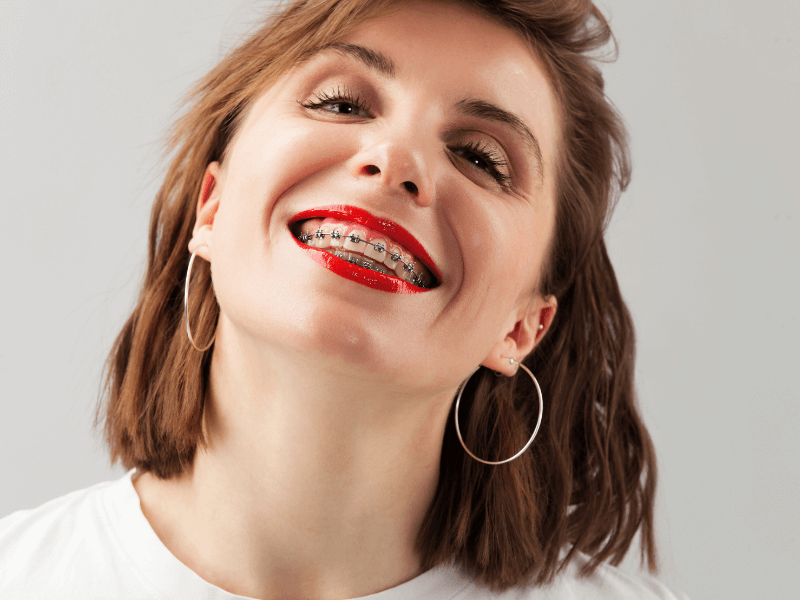 aparelho-dentario-preço