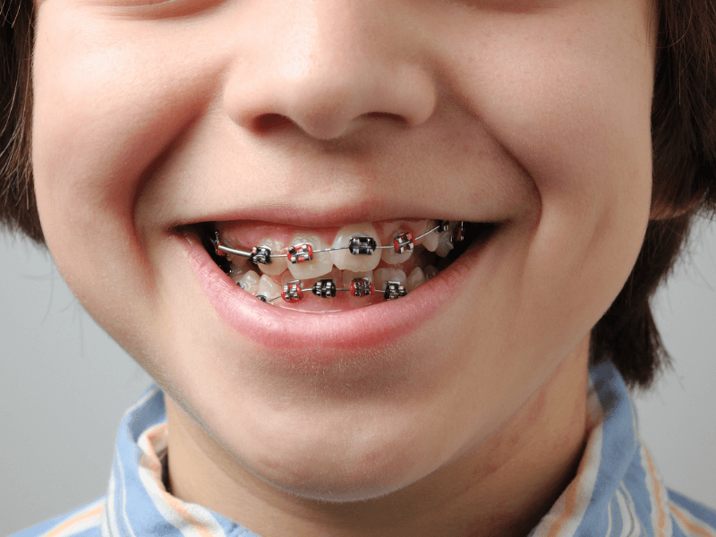 paciente com dentes tortos