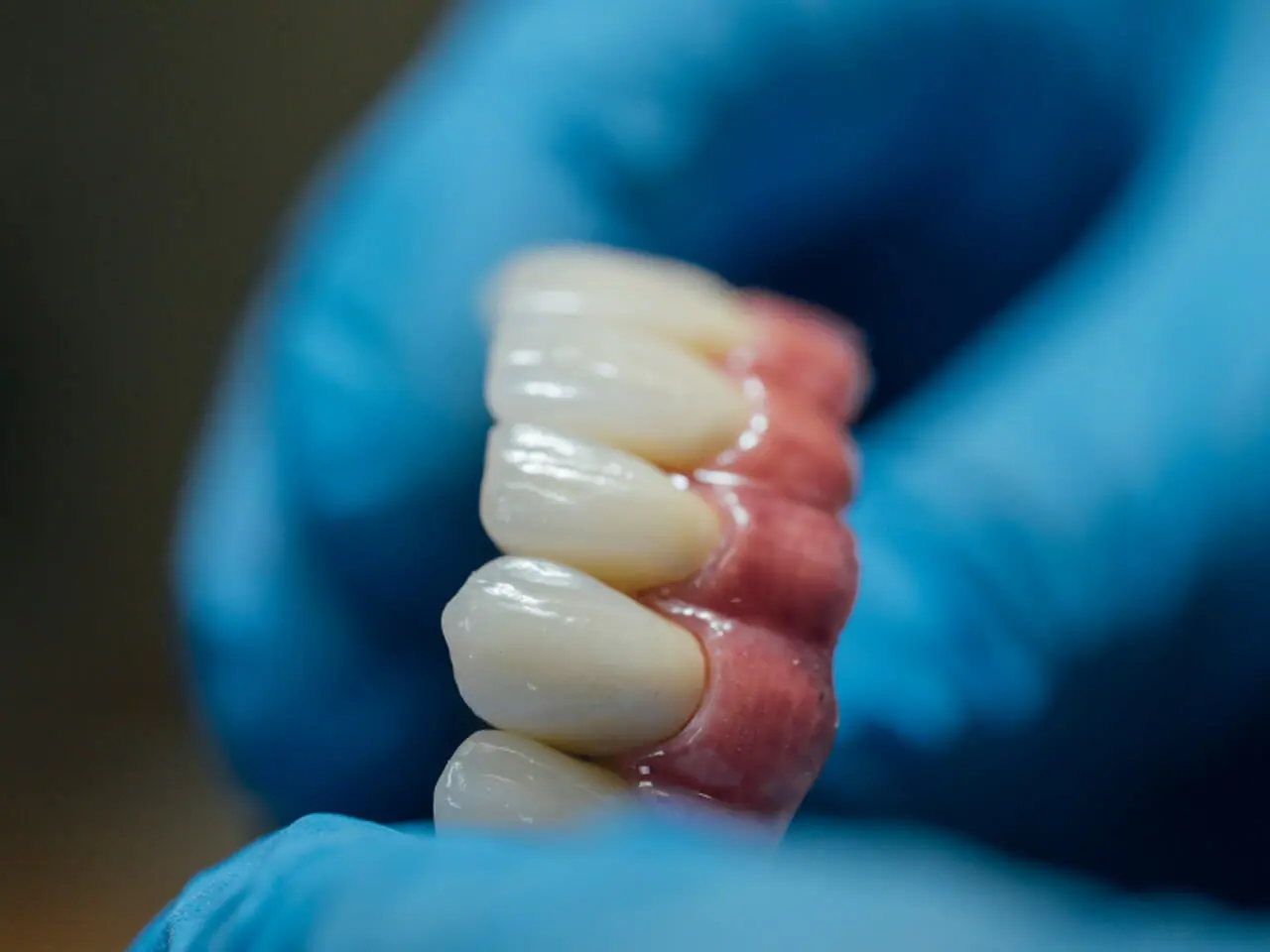 prótese dentária fixa
